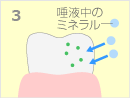 フッ素塗布